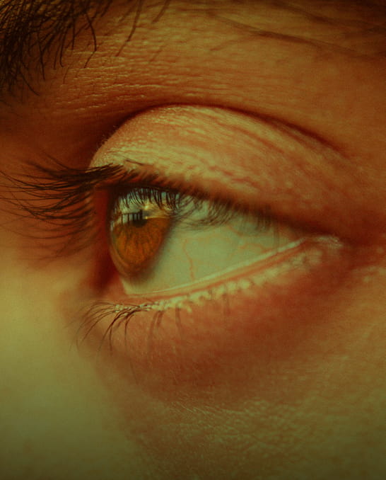 Itchy or Watery Eyes